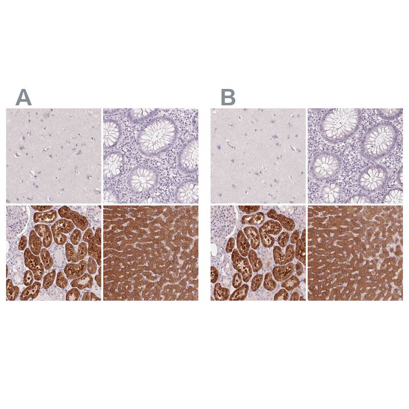 58K Golgi Protein Antibody - BSA Free Immunohistochemistry-Paraffin: 58K Golgi Protein Antibody [NBP2-48601]