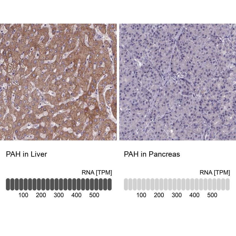 Phenylalanine Hydroxylase Antibody - BSA Free Immunohistochemistry-Paraffin: Phenylalanine Hydroxylase Antibody [NBP2-48615]