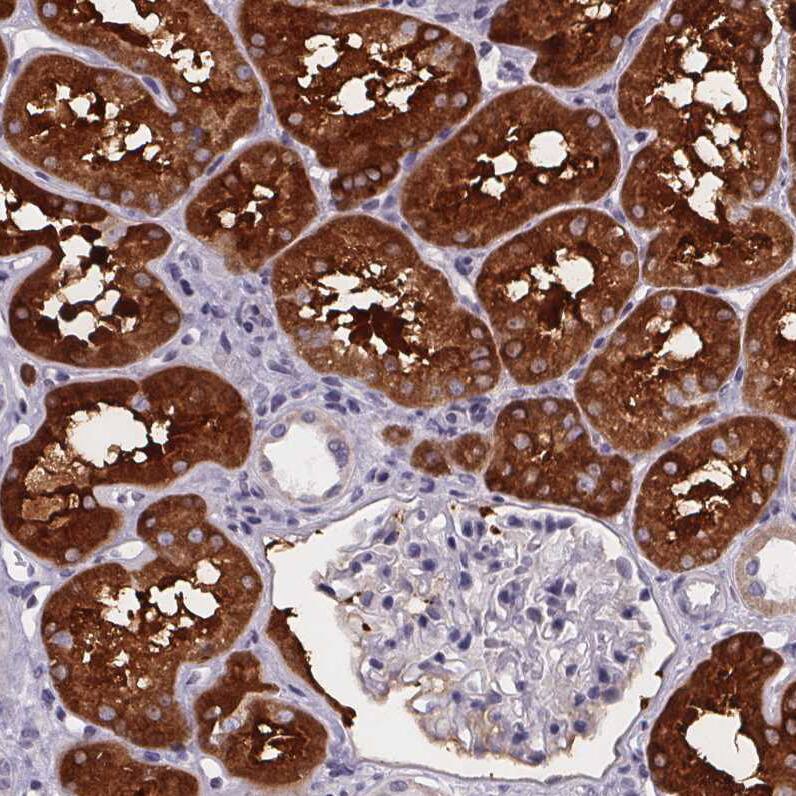 Phenylalanine Hydroxylase Antibody - BSA Free Immunohistochemistry-Paraffin: Phenylalanine Hydroxylase Antibody [NBP2-48615]