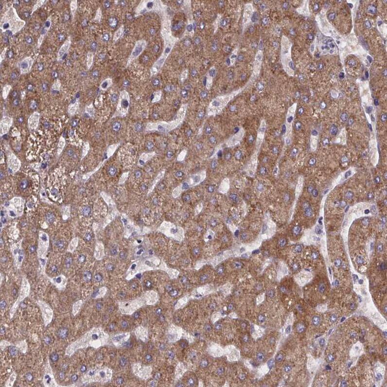 Phenylalanine Hydroxylase Antibody - BSA Free Immunohistochemistry-Paraffin: Phenylalanine Hydroxylase Antibody [NBP2-48615]