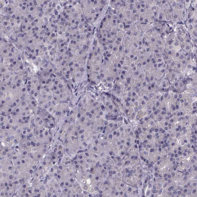 Phenylalanine Hydroxylase Antibody - BSA Free Immunohistochemistry-Paraffin: Phenylalanine Hydroxylase Antibody [NBP2-48615]