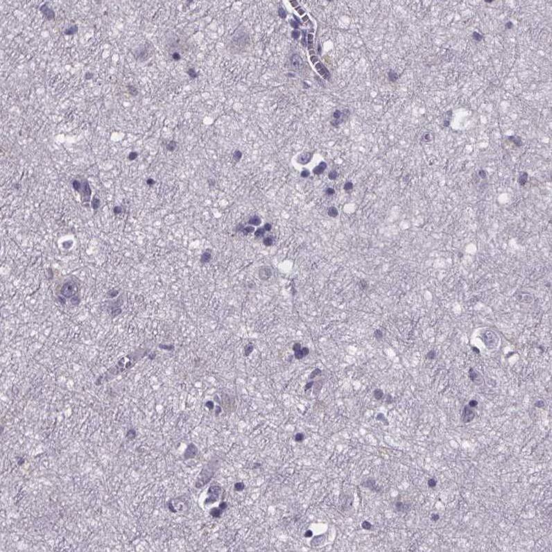 Phenylalanine Hydroxylase Antibody - BSA Free Immunohistochemistry-Paraffin: Phenylalanine Hydroxylase Antibody [NBP2-48615]