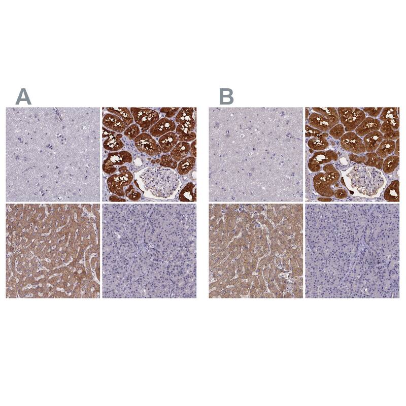 Phenylalanine Hydroxylase Antibody - BSA Free Immunohistochemistry-Paraffin: Phenylalanine Hydroxylase Antibody [NBP2-48615]