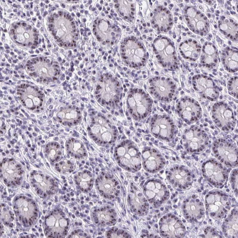 NIFK Antibody - BSA Free Immunohistochemistry-Paraffin: NIFK Antibody [NBP2-48642]