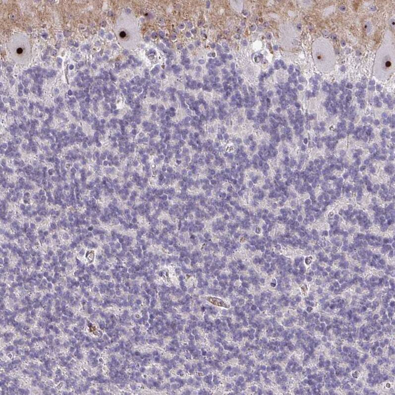 NIFK Antibody - BSA Free Immunohistochemistry-Paraffin: NIFK Antibody [NBP2-48642]
