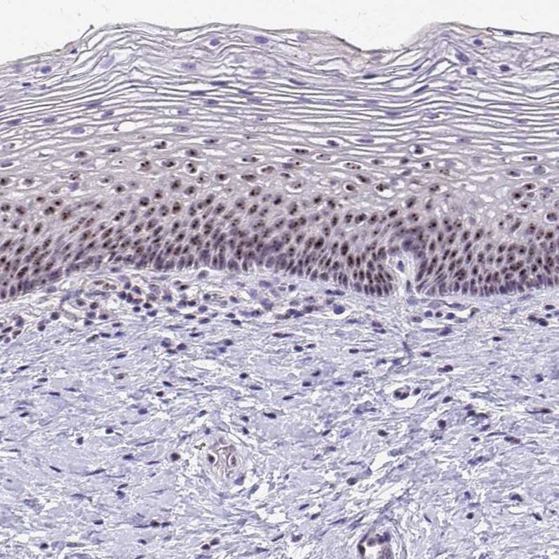 NIFK Antibody - BSA Free Immunohistochemistry-Paraffin: NIFK Antibody [NBP2-48642]