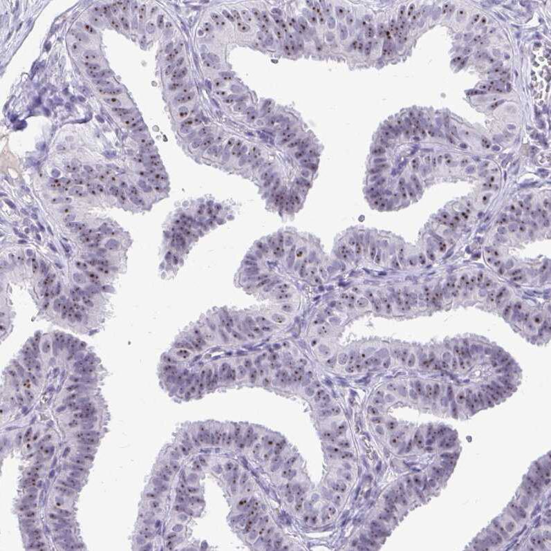 NIFK Antibody - BSA Free Immunohistochemistry-Paraffin: NIFK Antibody [NBP2-48642]