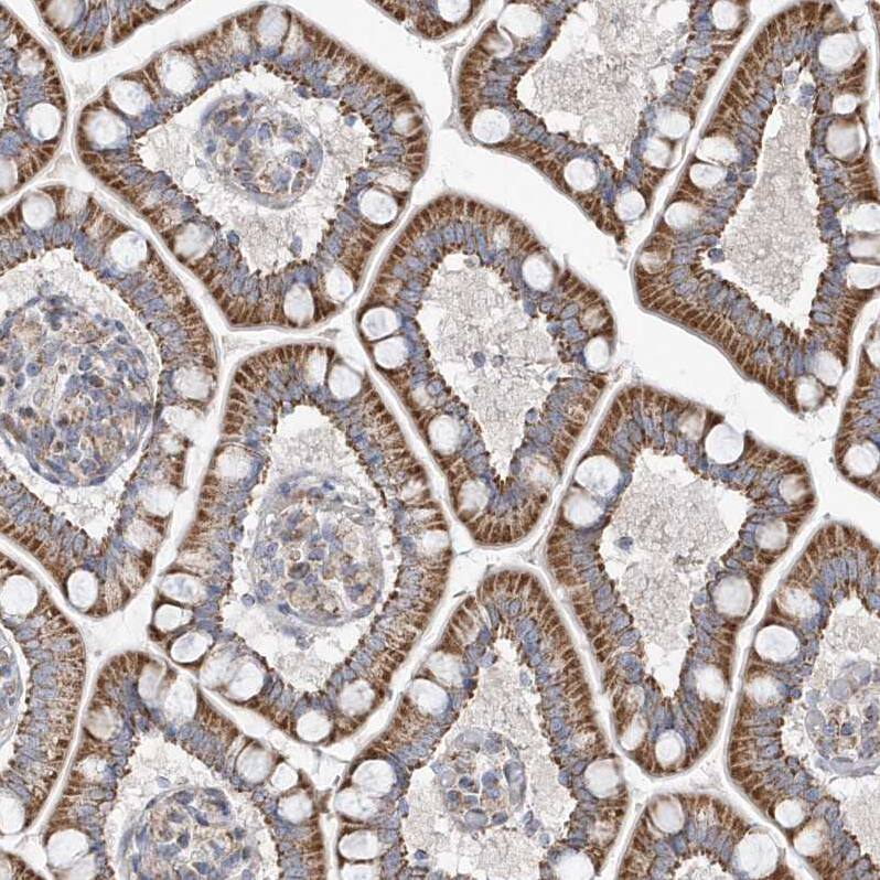 OPA1 Antibody - BSA Free Immunohistochemistry-Paraffin: OPA1 Antibody [NBP2-48669]