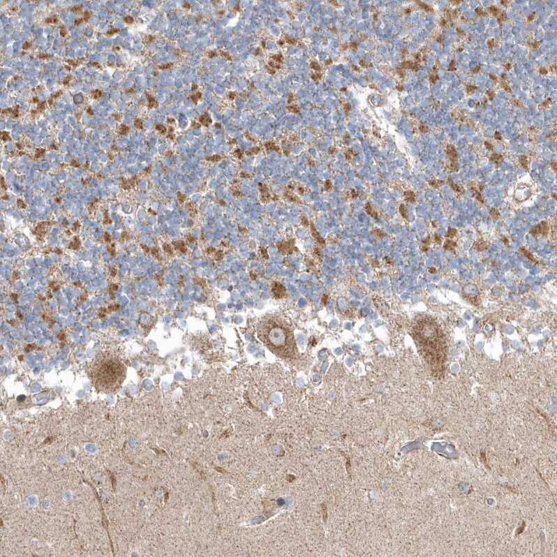 OPA1 Antibody - BSA Free Immunohistochemistry-Paraffin: OPA1 Antibody [NBP2-48669]
