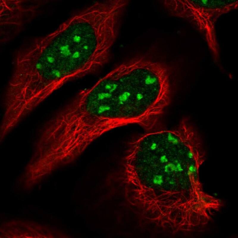 Dnmt2 Antibody - BSA Free Immunocytochemistry/ Immunofluorescence: Dnmt2 Antibody [NBP2-48670]