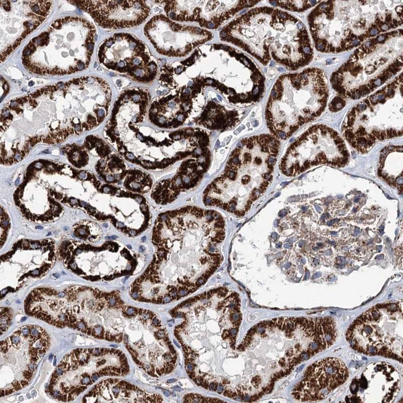 STK22C Antibody - BSA Free Immunohistochemistry-Paraffin: STK22C Antibody [NBP2-48674]