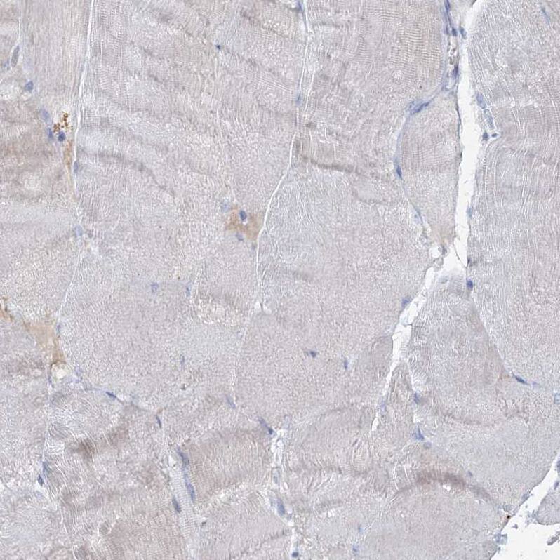 RFX6 Antibody - BSA Free Immunohistochemistry-Paraffin: RFX6 Antibody [NBP2-48677]
