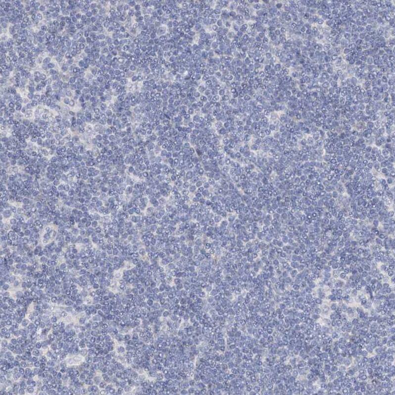 RFX6 Antibody - BSA Free Immunohistochemistry-Paraffin: RFX6 Antibody [NBP2-48677]