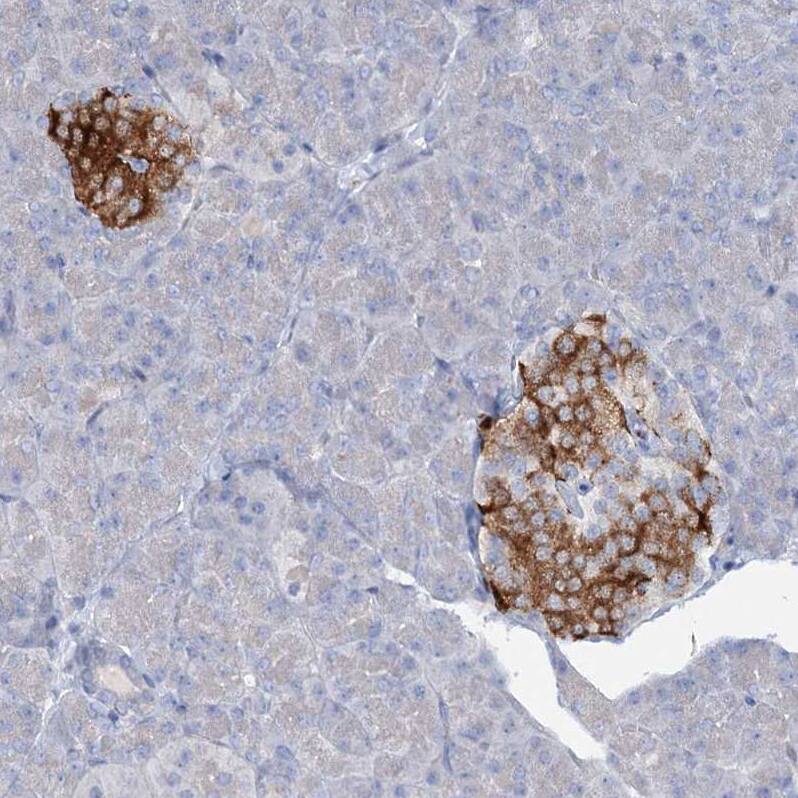 RFX6 Antibody - BSA Free Immunohistochemistry-Paraffin: RFX6 Antibody [NBP2-48677]