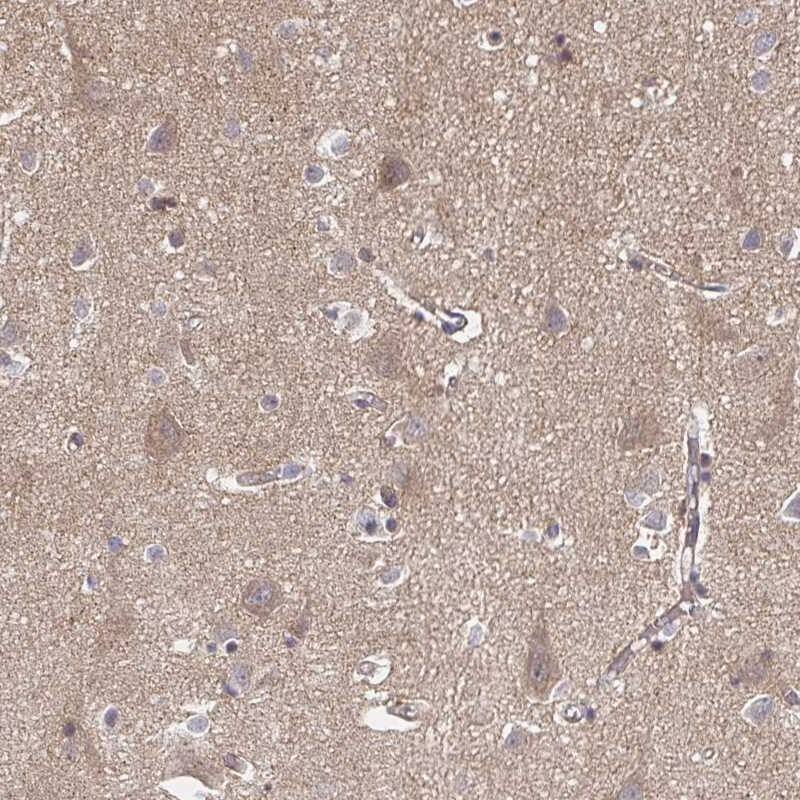 FE65 Antibody - BSA Free Immunohistochemistry-Paraffin: FE65 Antibody [NBP2-48682]