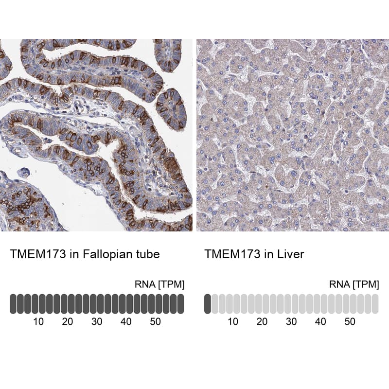 STING/TMEM173 Antibody - BSA Free Immunohistochemistry-Paraffin: STING/TMEM173 Antibody [NBP2-48684]