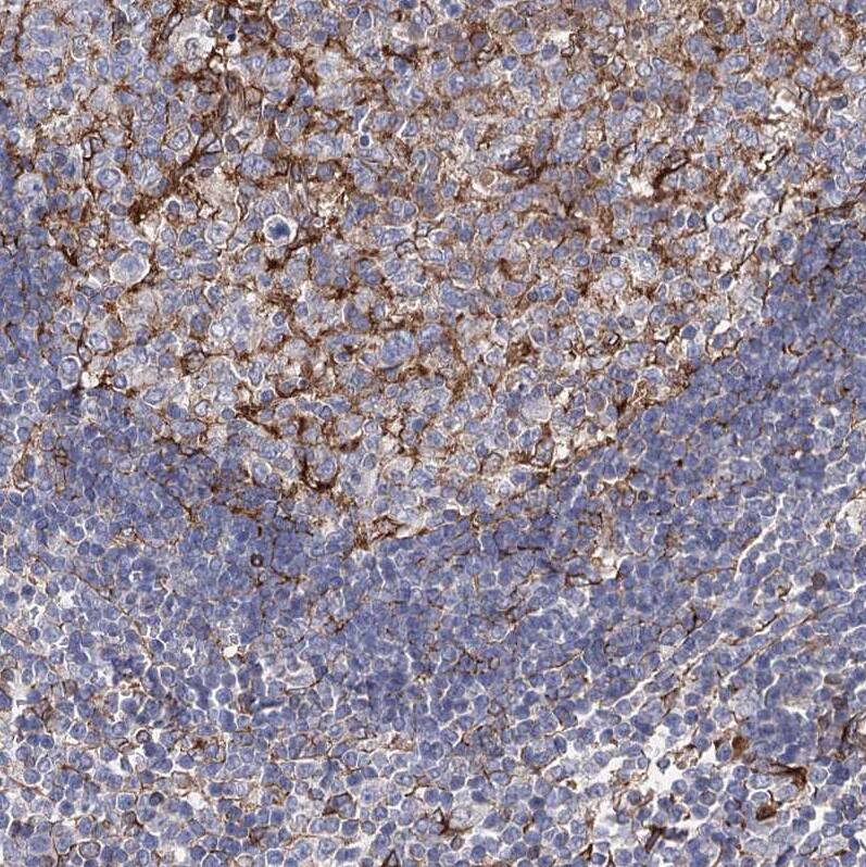 STING/TMEM173 Antibody - BSA Free Immunohistochemistry-Paraffin: STING/TMEM173 Antibody [NBP2-48684]
