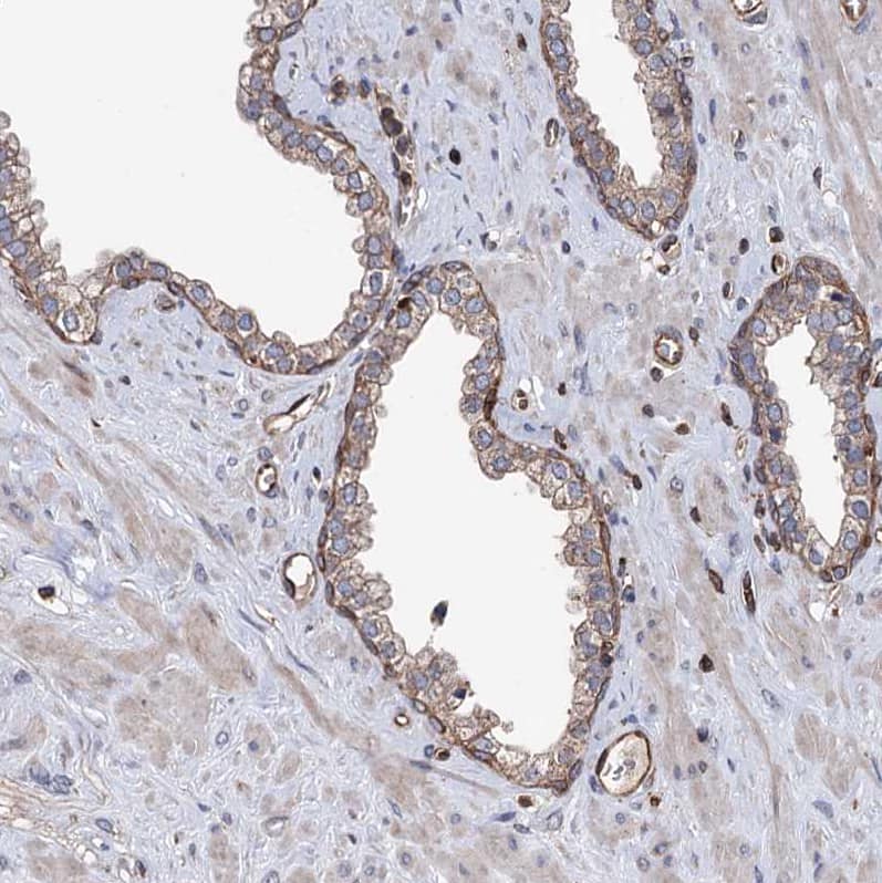 STING/TMEM173 Antibody - BSA Free Immunohistochemistry-Paraffin: STING/TMEM173 Antibody [NBP2-48684]