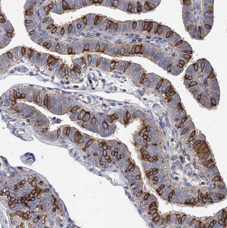 STING/TMEM173 Antibody - BSA Free Immunohistochemistry-Paraffin: STING/TMEM173 Antibody [NBP2-48684]