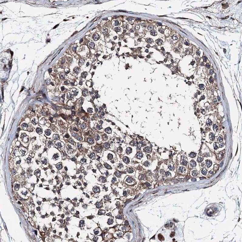 noxin Antibody - BSA Free Immunohistochemistry-Paraffin: noxin Antibody [NBP2-48685]