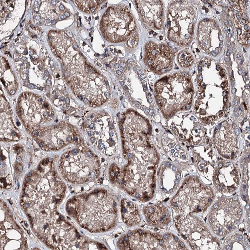 noxin Antibody - BSA Free Immunohistochemistry-Paraffin: noxin Antibody [NBP2-48685]
