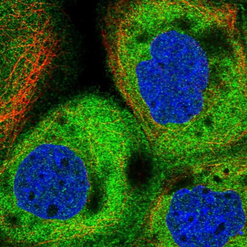 CIP2A Antibody - BSA Free Immunocytochemistry/ Immunofluorescence: CIP2A Antibody [NBP2-48710]