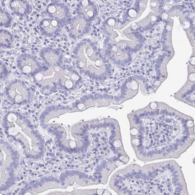SCP3/SYCP3 Antibody - BSA Free Immunohistochemistry-Paraffin: SCP3/SYCP3 Antibody [NBP2-48713]