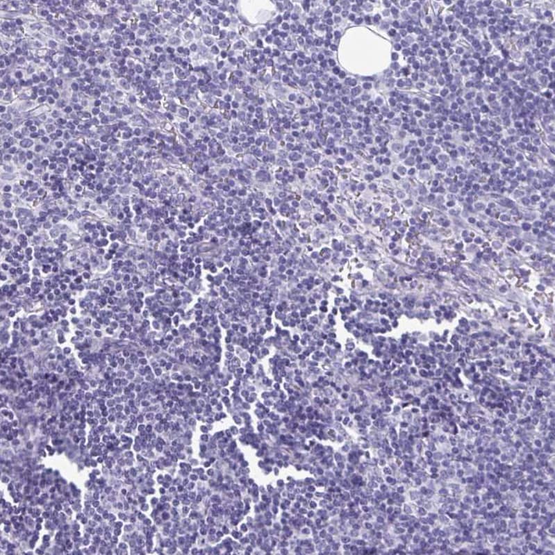 SCP3/SYCP3 Antibody - BSA Free Immunohistochemistry-Paraffin: SCP3/SYCP3 Antibody [NBP2-48713]