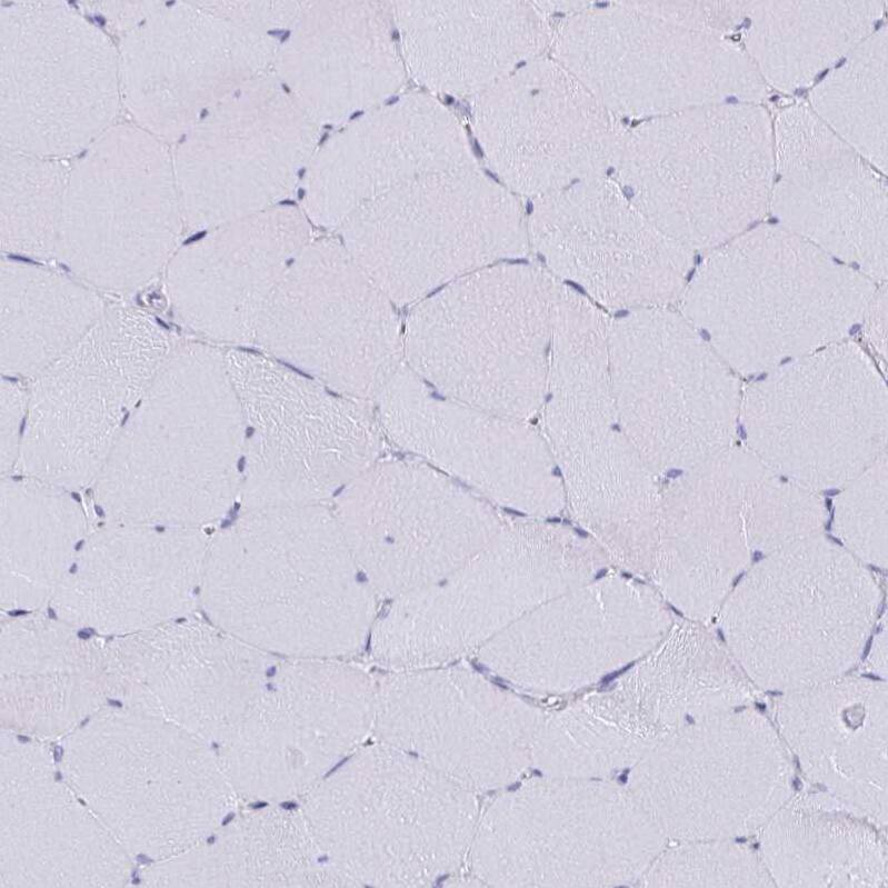 SCP3/SYCP3 Antibody - BSA Free Immunohistochemistry-Paraffin: SCP3/SYCP3 Antibody [NBP2-48713]