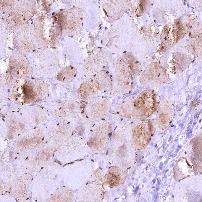 GAPDH Antibody - BSA Free Immunohistochemistry-Paraffin: GAPDH Antibody [NBP2-48721]