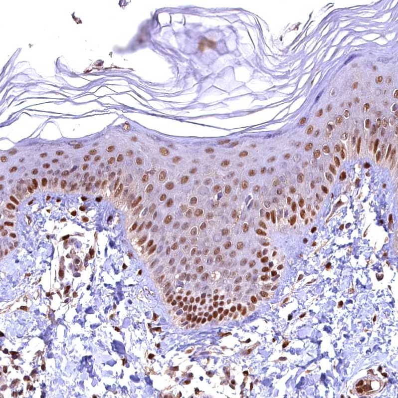GAPDH Antibody - BSA Free Immunohistochemistry-Paraffin: GAPDH Antibody [NBP2-48721]