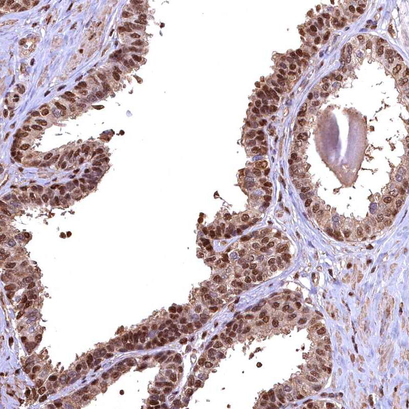 GAPDH Antibody - BSA Free Immunohistochemistry-Paraffin: GAPDH Antibody [NBP2-48721]