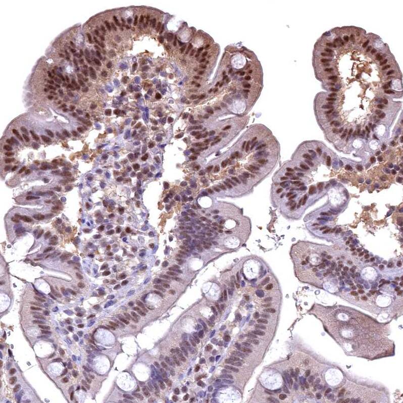 GAPDH Antibody - BSA Free Immunohistochemistry-Paraffin: GAPDH Antibody [NBP2-48721]