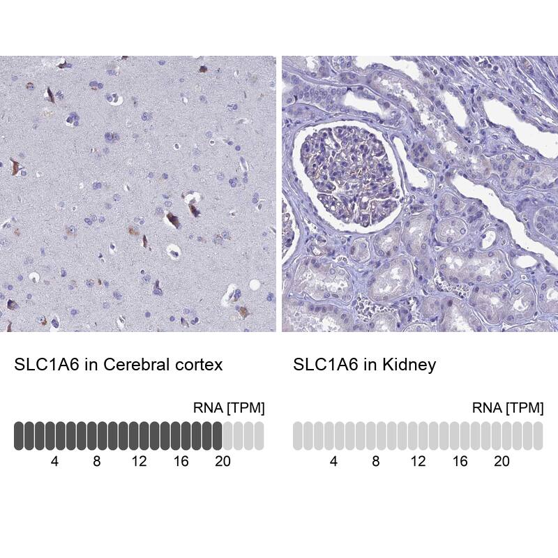 EAAT4 Antibody - BSA Free Immunohistochemistry-Paraffin: EAAT4 Antibody [NBP2-48740]