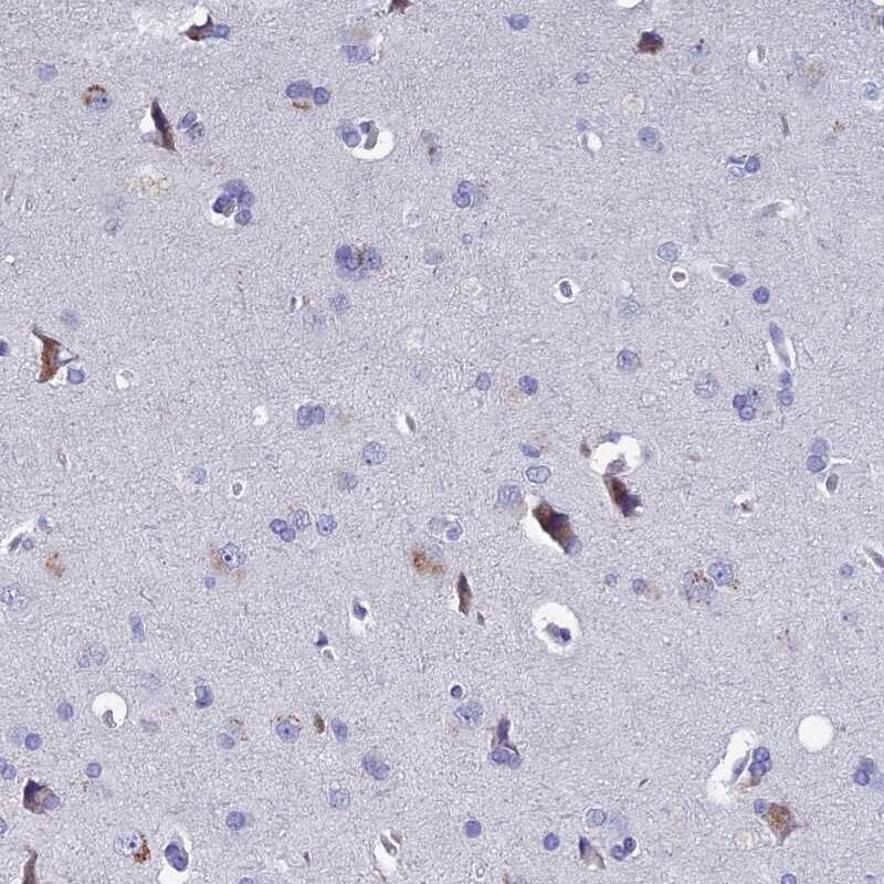 EAAT4 Antibody - BSA Free Immunohistochemistry-Paraffin: EAAT4 Antibody [NBP2-48740]