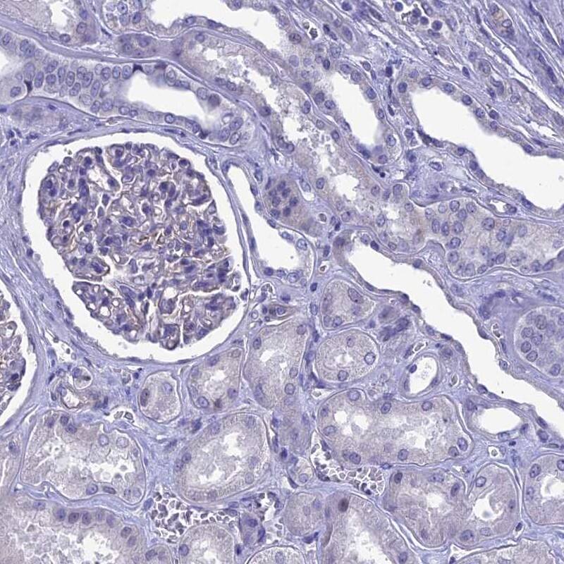 EAAT4 Antibody - BSA Free Immunohistochemistry-Paraffin: EAAT4 Antibody [NBP2-48740]