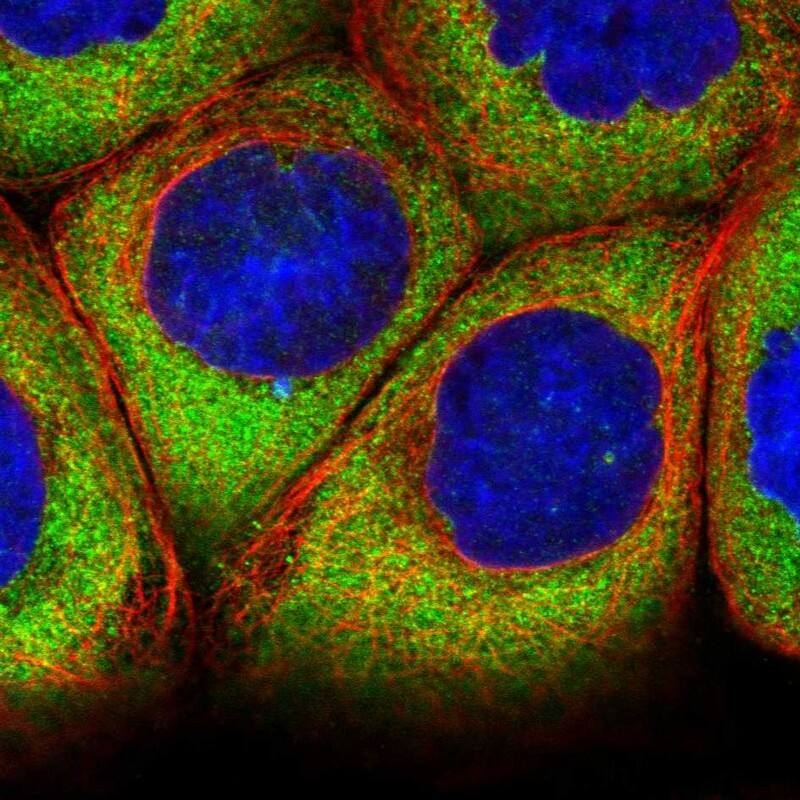 Ataxin-2-like protein Antibody - BSA Free Immunocytochemistry/ Immunofluorescence: Ataxin-2-like protein Antibody [NBP2-48741]