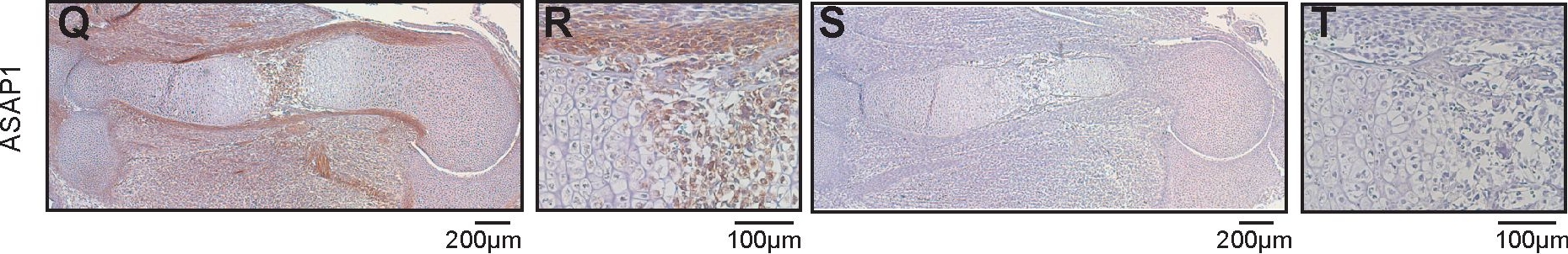 ASAP1 Antibody