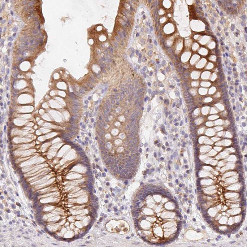 Rab11A Antibody - BSA Free Immunohistochemistry-Paraffin: Rab11A Antibody - BSA Free [NBP2-49320]