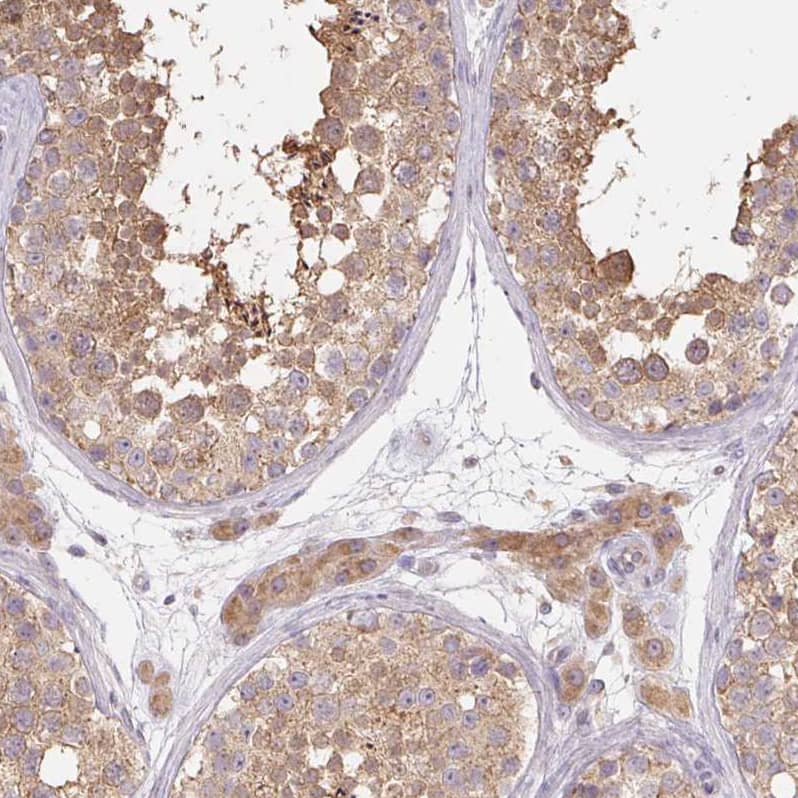 Rab11A Antibody - BSA Free Immunohistochemistry-Paraffin: Rab11A Antibody - BSA Free [NBP2-49320]