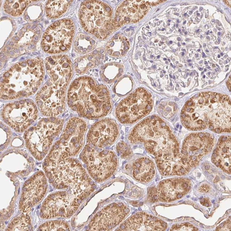 Rab11A Antibody - BSA Free Immunohistochemistry-Paraffin: Rab11A Antibody - BSA Free [NBP2-49320]