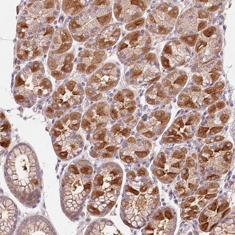 Rab11A Antibody - BSA Free Immunohistochemistry-Paraffin: Rab11A Antibody - BSA Free [NBP2-49320]