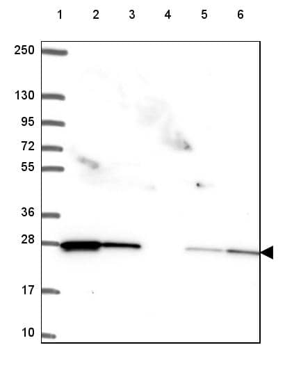 Rab11A Antibody - BSA Free Western Blot: Rab11A Antibody - BSA Free [NBP2-49320]