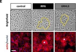 IRF6 Antibody - BSA Free