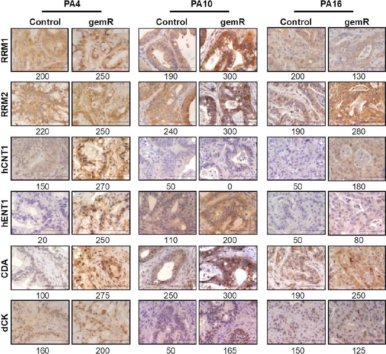 RRM1 Antibody