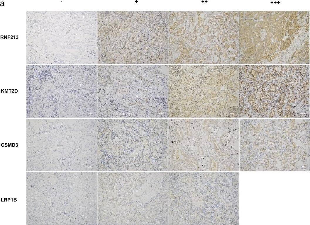 LRP-1B Antibody - BSA Free