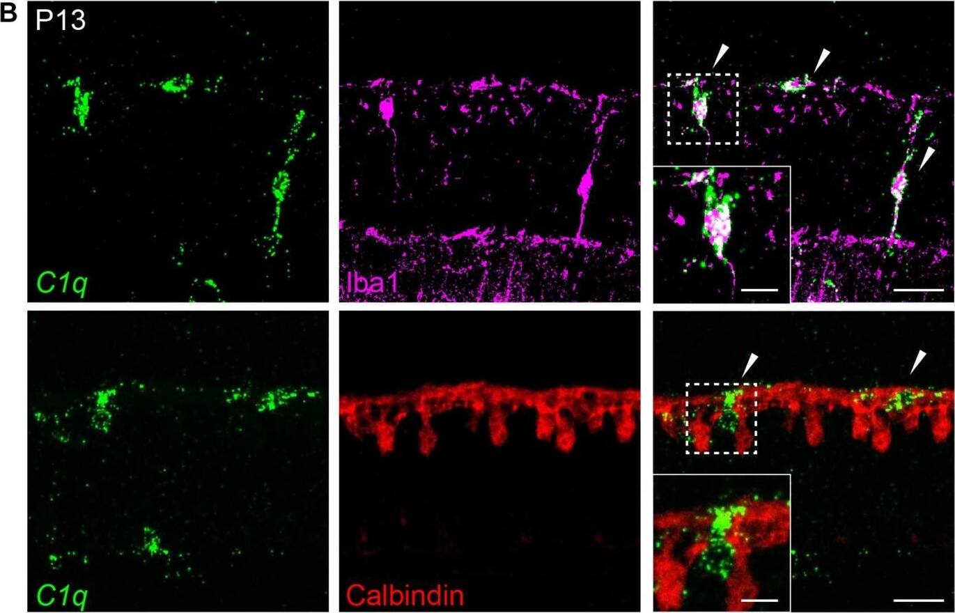 Calbindin D-28K Antibody