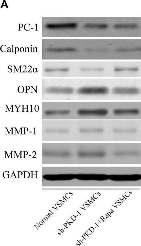 Polycystin-1/PKD1 Antibody (PKS161f/B7) - BSA Free