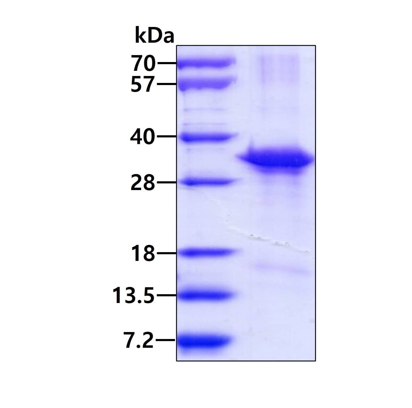 Recombinant Human CD45 His Protein