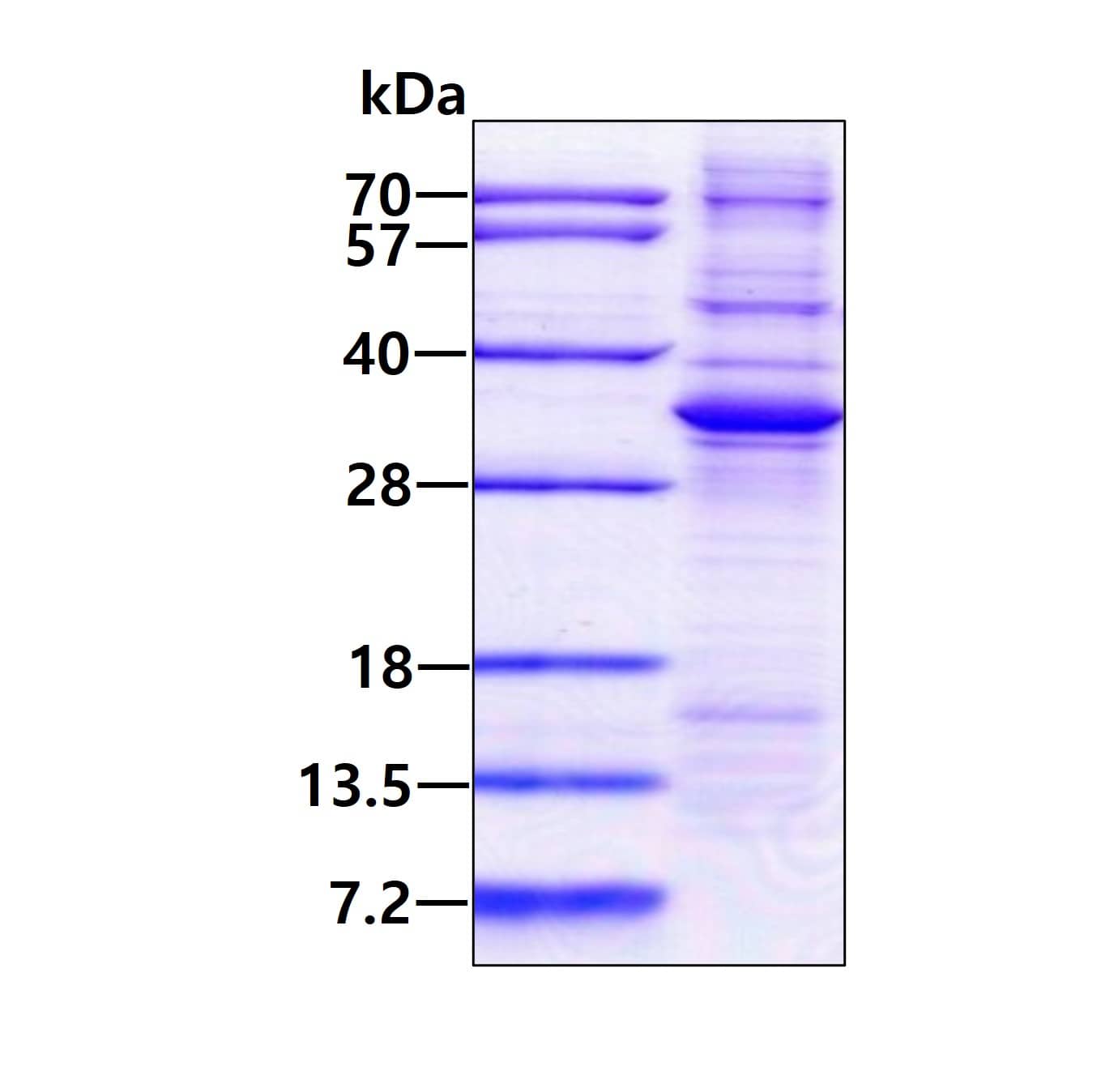 Recombinant Human ADAL His Protein